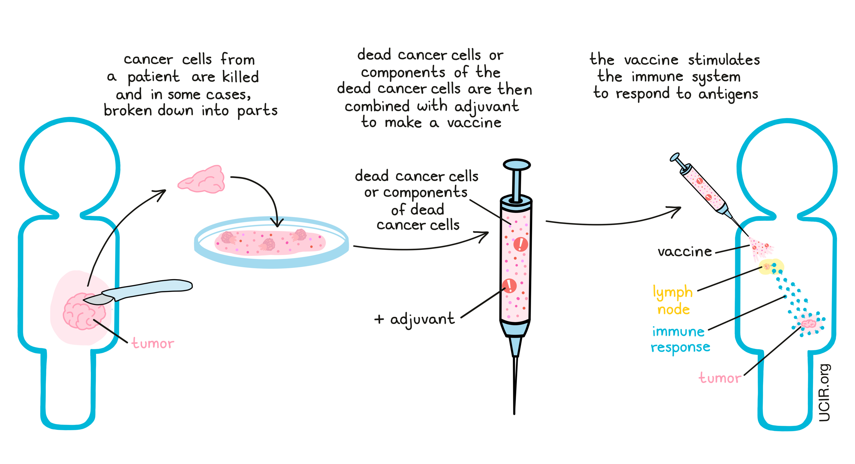 Cancer patients show good COVID immune response to vaccine, infection