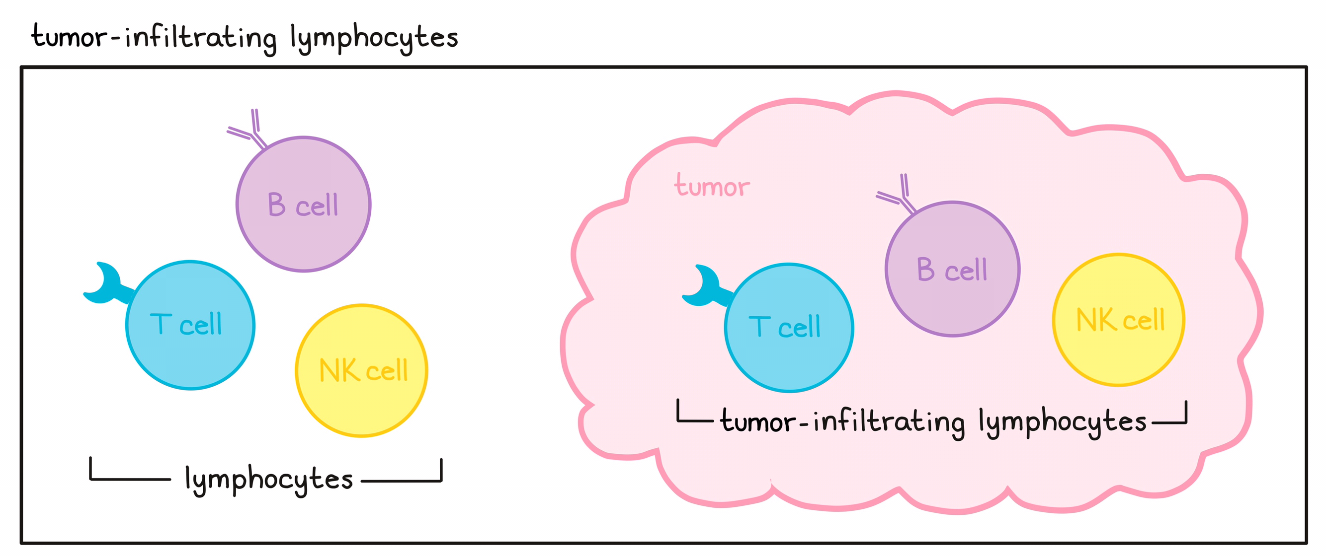 Image showing lymphocytes inside a tumor